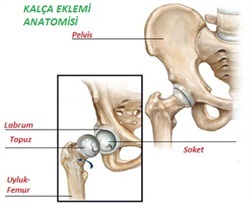 kalçaprotezi