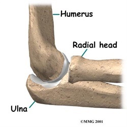 Radius Başı Kırıkları