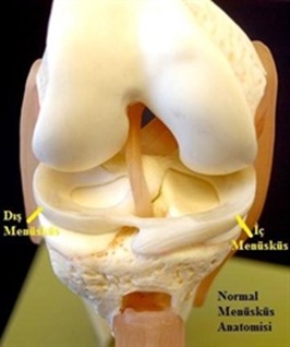 Diskoid menisküs