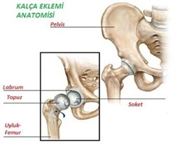 kalça çıkığı