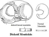 menisküs