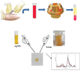 Preparation-of-blood-samples-Peripheral-blood-samples-were-taken-3-mL-into